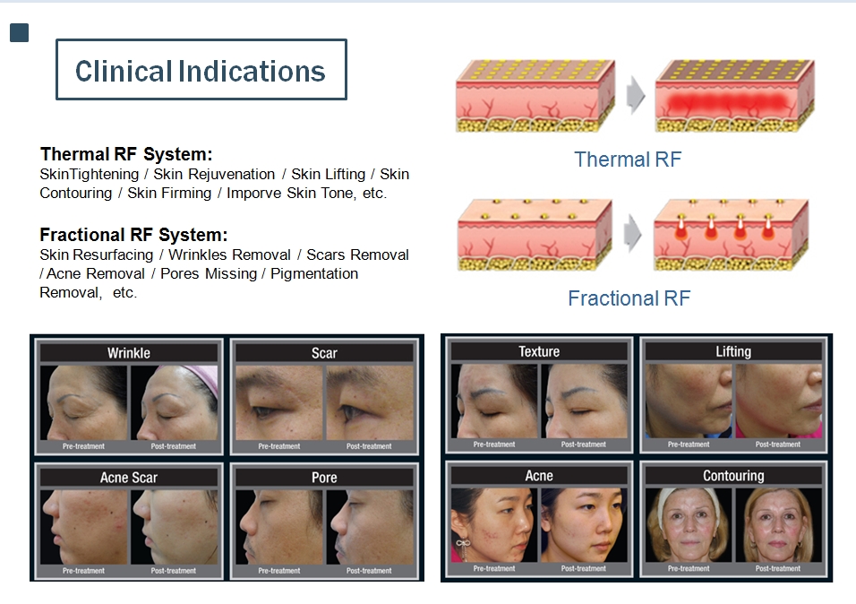clinical indications