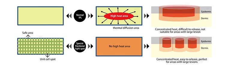 Skin Rejuvenation Machine Skin Rejuvenation machine