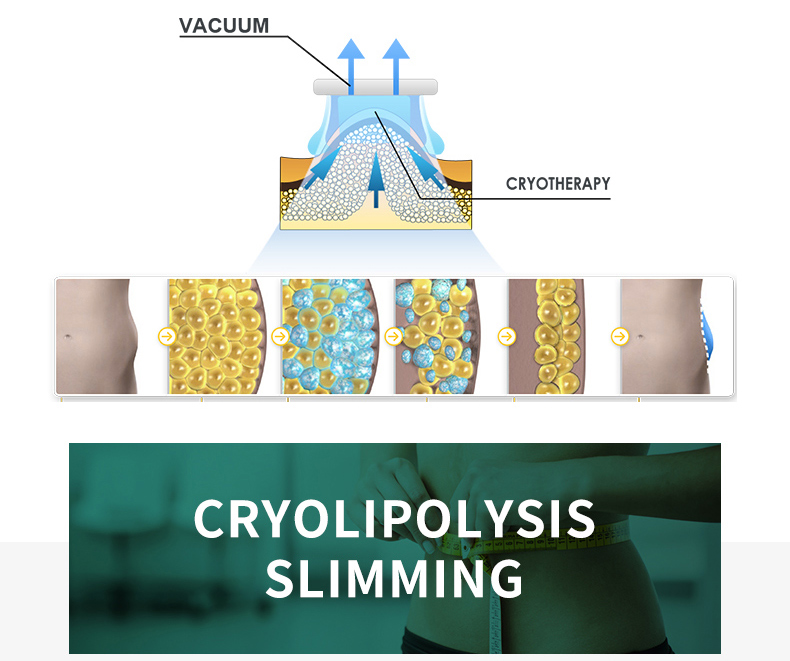 Cryolipolysis Slimming Machine