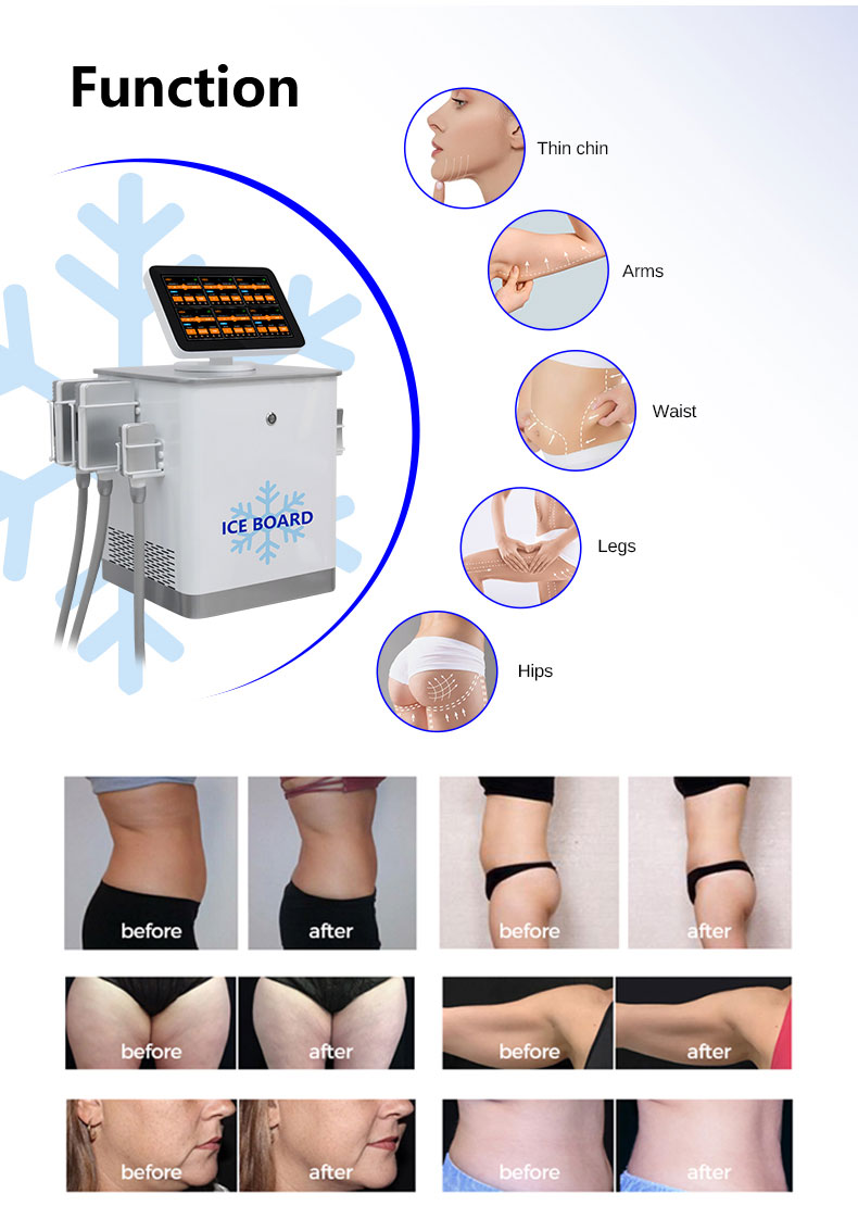 Frozen Board Slimming Machine
