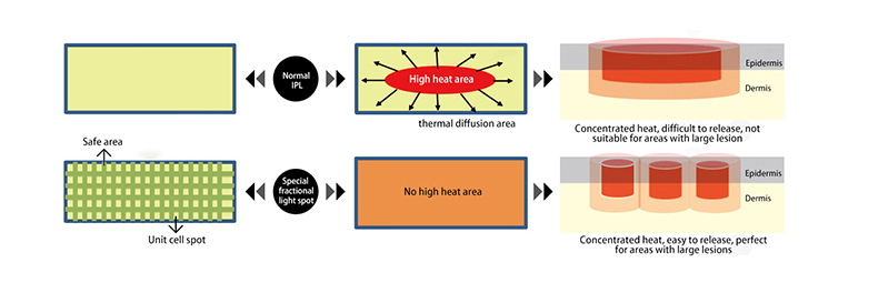Professional Skin Rejuvenation machine