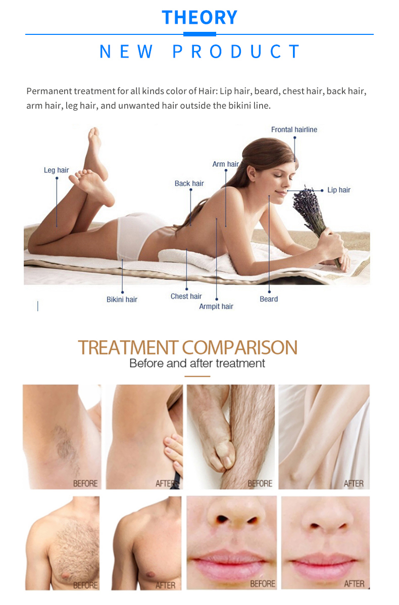 laser hair removal machine