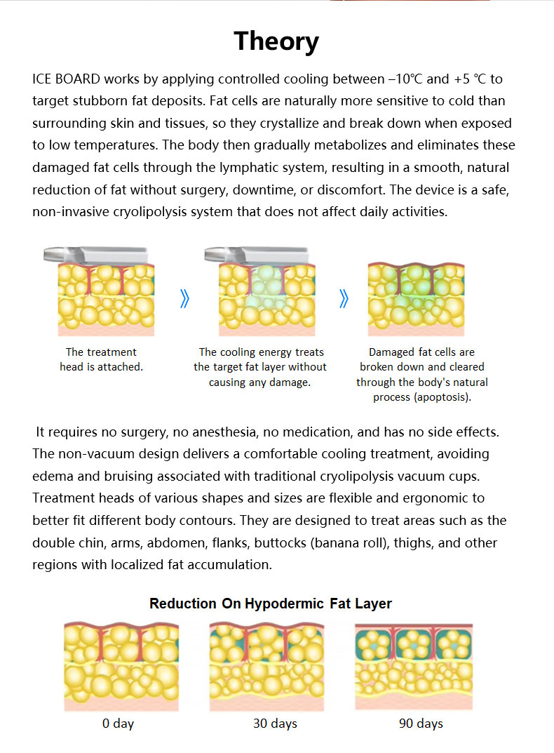 Frozen Board Slimming Machine