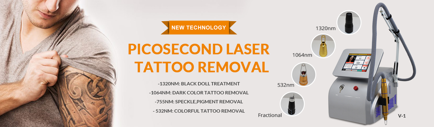 picosecond laser tattoo removal
