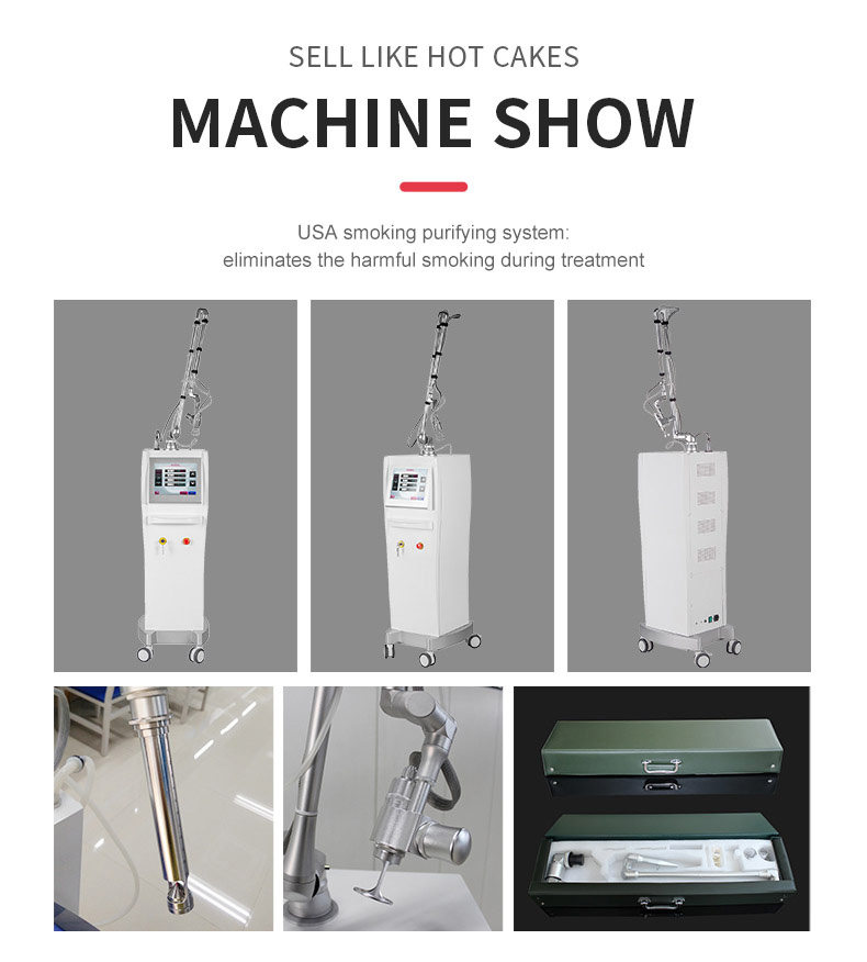 Stretch Marks Acne Removal