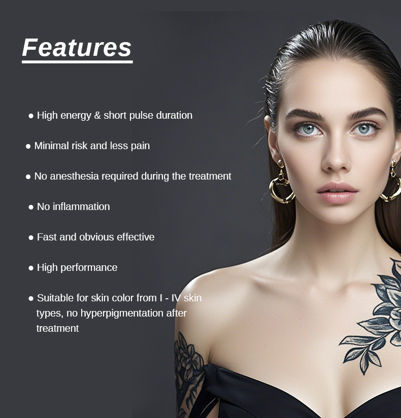 laser tattoo removal