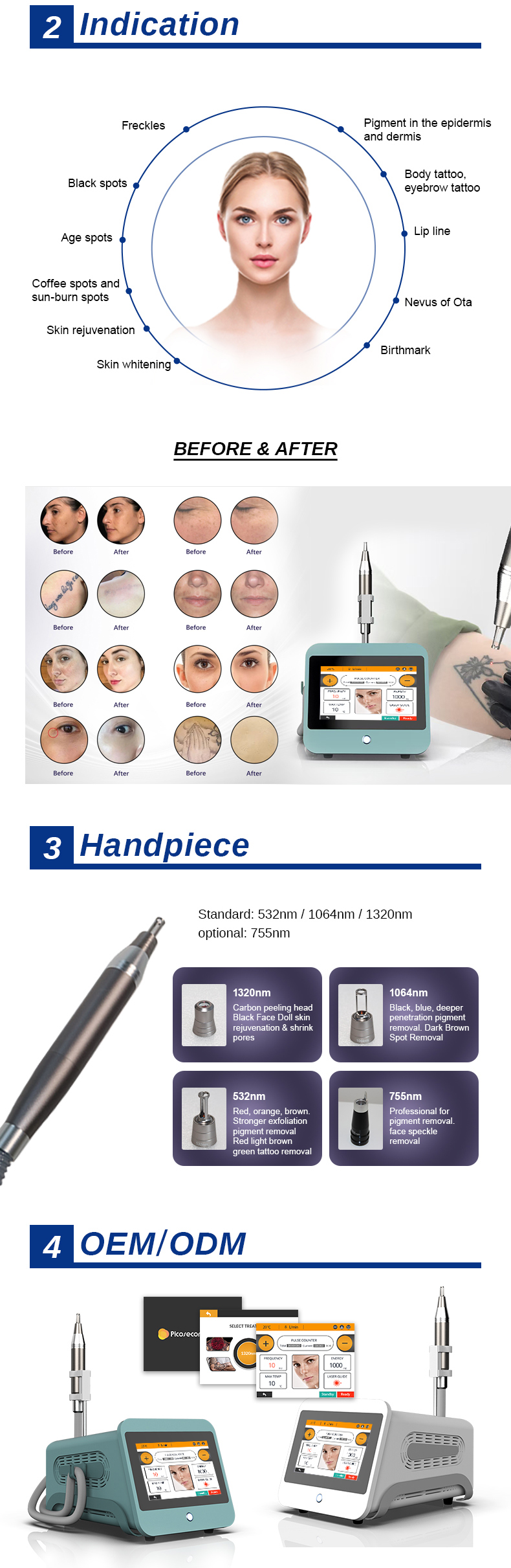 tattoo removal machine