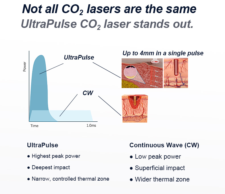 CO2 Fractional Laser