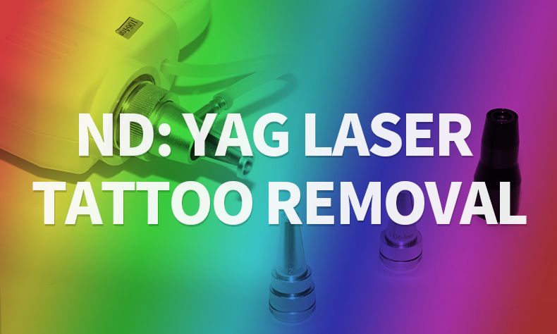 Best laser machine for tattoo removal