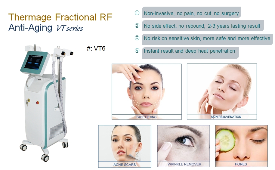 5th Thermage Fractional RF for Wrinkle Removal Beijing VCA Laser