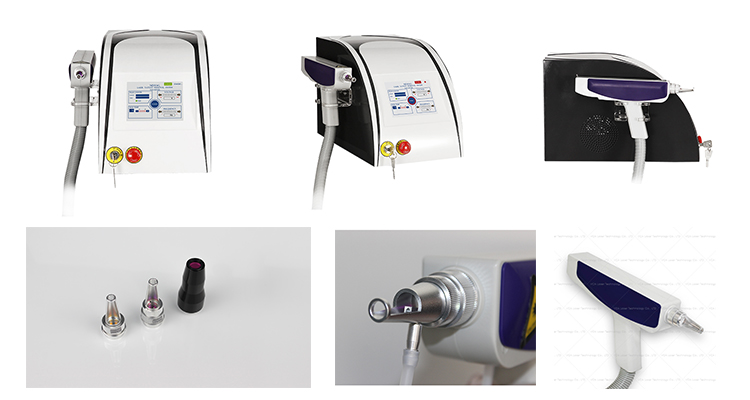 laser tattoo removal