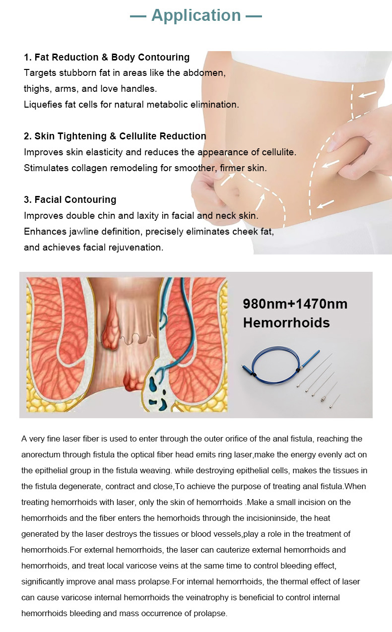 diode laser lipolysis machine