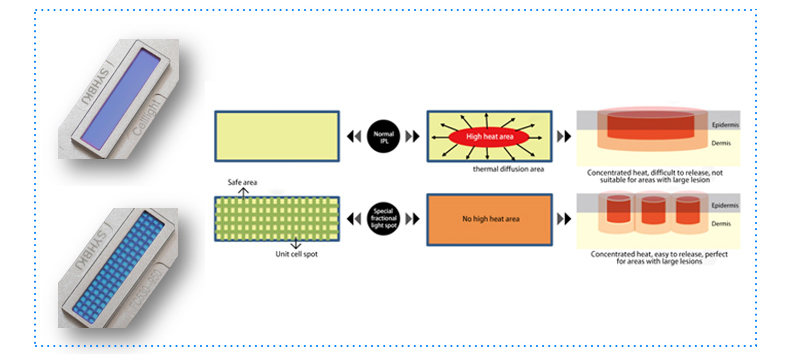 2. Two forms of density output, honeycomb spot and specular spot Fractional light spot, honeycomb instant transmission technology, improve the safety of large-area clinical treatment