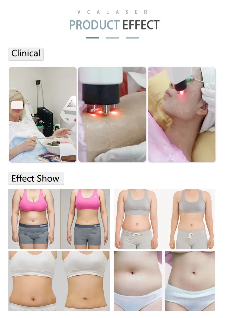 cavitation slimming machine