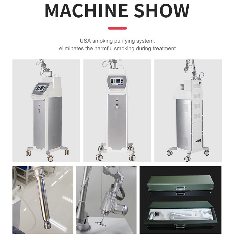 Fractional Laser Co2