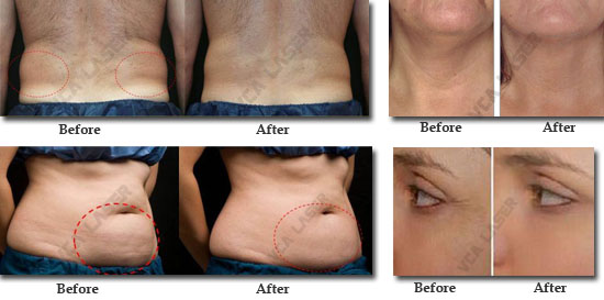 treatment-MARK550(6)