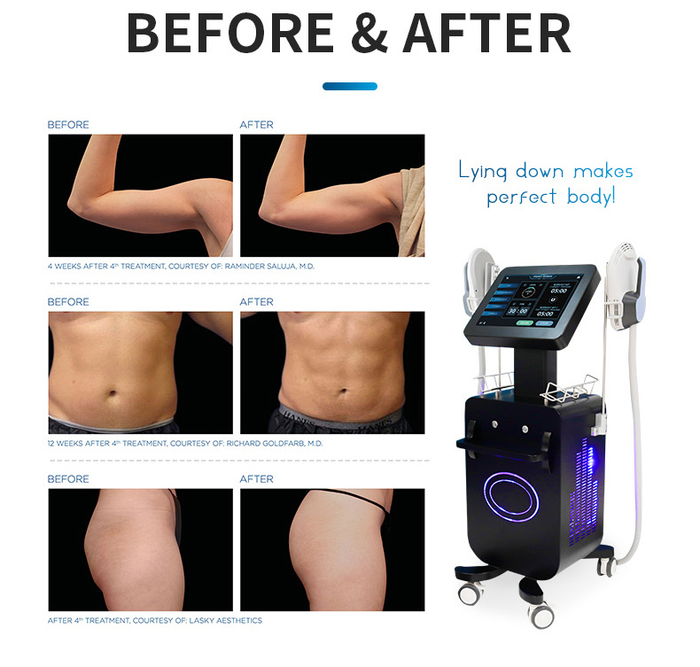 emsculpt machine